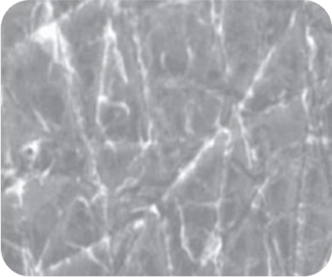 A microscopic or close-up view showing dry, cracked, and flaking skin texture with pronounced white lines and scaling.