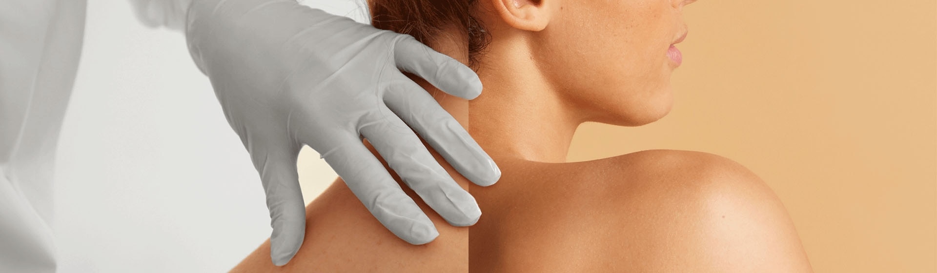 A close-up split-screen image showing a medical practitioner in a gloved hand examining a patient's neck and shoulder on the left, alongside the bare neck and shoulder of the woman on the right.