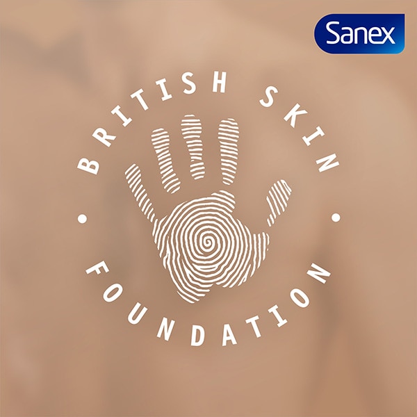 Swirl pattern imprinted on handprint.