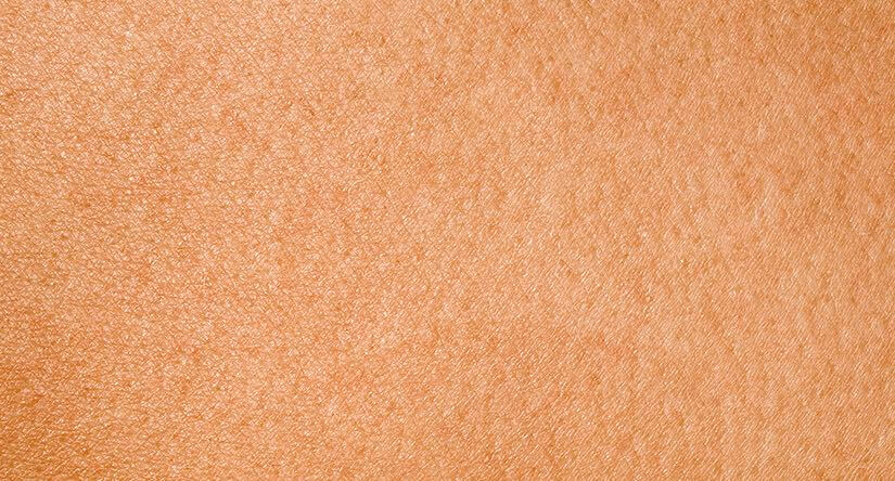 How to care for combination skin: Causes, care and prevention advice How to care for combination skin: Causes, care and prevention advice